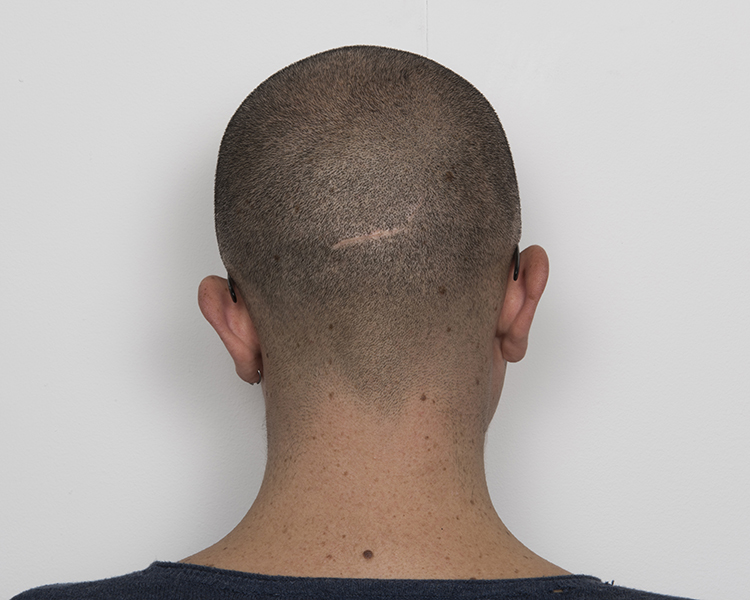 Backhead, 30cmx40cm, inkjet on cotton paper, 2015